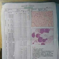 请把爱心给这个可怜又懂事的白血病女孩一个生的机会_0