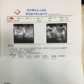 终于下定决心要二胎宝宝，二胎孕前检查还是必不可少的_3