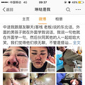 可怕！！！女子丽江旅游差点被打死，图片血腥_0