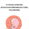 得甲状腺疾病的越来越多，甲状腺是什么？在哪里？【孕期龙门阵】_2