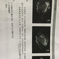 长了巧克力囊肿怎么办