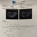 子宫肌瘤成了我备孕路上的拦路虎，差点让我贴上了不孕标签！_1