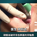 当心！小伙每天喝3瓶碳酸饮料牙齿烂穿_3