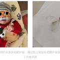 孕18周的时候体检出宝宝是兔唇，出生后两周内就做了正畸手术_3