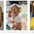 孕18周的时候体检出宝宝是兔唇，出生后两周内就做了正畸手术_0