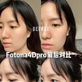 Fotona4DProһϵĵһ
