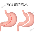 胃越撑越大，越饿越小？真相是……_0