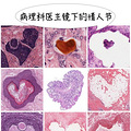 体检发现全身结节，我惊动了一群“社恐”医生_1