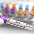2ͯڳ˻׿飬ȷȾHPV