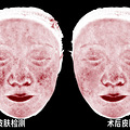 敏感肌治疗过程分享-真实贴_3