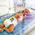 怀胎十月体重增80斤 260斤孕妇产低血糖宝宝