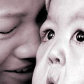1岁半女婴患怪病 皮肤松弛似老人(图)_1