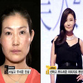 韩国整容节目堪称改头换面 中年大婶变张曼玉