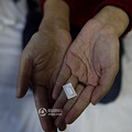  “紫嘴唇”患者的梦 _3