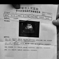 男子彩超显示子宫卵巢未见异常 院方致歉
