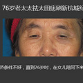 杭州76岁老太刷新整容记录