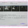 【雅布力孕妈日记】哭过之后，就是甜美，我在这等你到来！_2