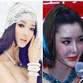 因整形失败酿苦果的10大当红女星_2