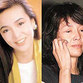 因整形失败酿苦果的10大当红女星_3