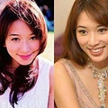 因整形失败酿苦果的10大当红女星_5