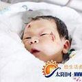 厦门奇迹宝宝平安度过第一天 奶奶等5人今日来厦