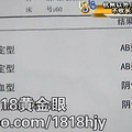 寻找Rh AB型血型：“熊猫血”中的“熊猫血” _0