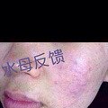 hc万色水母使用后为什么会变白