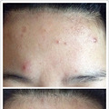 W小姐的美白日记（经验总结）_3