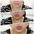 爱美肌3件套焕颜修复套 爱美肌焕颜修复套盒_0
