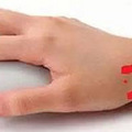 手腕内侧腱鞘炎