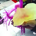 【立功了！】病儿太重，母亲捐肝不够用，医