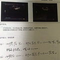 喜得猴宝，备孕过程分享_3