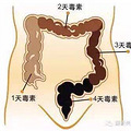 小傅口臭与排毒是否有关系呢？吃伊瘦酵素青梅管用吗？_1