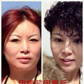 小傅口臭与排毒是否有关系呢？吃伊瘦酵素青梅管用吗？_3