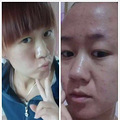 小傅口臭与排毒是否有关系呢？吃伊瘦酵素青梅管用吗？_2