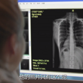 别光看欧巴撩妹了 看太阳的后裔提到的日常急救知识！_3