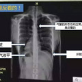 别光看欧巴撩妹了 看太阳的后裔提到的日常急救知识！_4