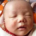 【今日热点】妈妈必看 | 新生儿皮肤问题大汇总_1