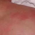 【今日热点】妈妈必看 | 新生儿皮肤问题大汇总_0