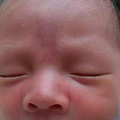 【今日热点】妈妈必看 | 新生儿皮肤问题大汇总_2