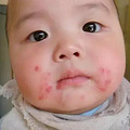【今日热点】妈妈必看 | 新生儿皮肤问题大汇总_5