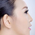 如何消除面部浮肿？怎么消除面部浮肿？_2