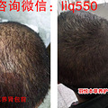 羽悦本草养肾包多少钱？效果怎么样？_1