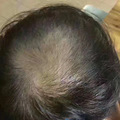 羽悦本草养肾包多少钱？效果怎么样？_2