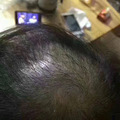 羽悦本草养肾包多少钱？效果怎么样？_3