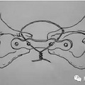 推拿专家范炳华 ：那么多妈妈喊腰痛，真是月子没坐好的原因吗？_4