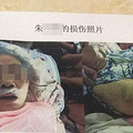 男护工3.5小时掌掴老人57次！儿子看哭：我花钱让爹挨打_1