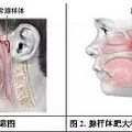 4岁宝宝腺样体肥大痊愈！12个月辛酸煎熬，为人父母才会懂！！