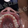 看牙科杭州哪个医院好，儿童牙齿正畸，趁暑期给孩子大变样_3