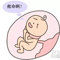 脐带绕颈不可怕，学几招可预防！_0